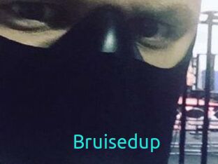 Bruisedup